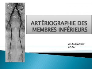 ARTRIOGRAPHIE DES MEMBRES INFRIEURS Dr AMENZOUY Dr ALJ