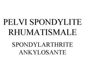 PELVI SPONDYLITE RHUMATISMALE SPONDYLARTHRITE ANKYLOSANTE GENERALITES Gnralits rhumatisme