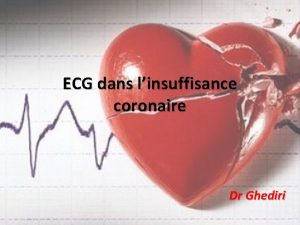 ECG dans linsuffisance coronaire Dr Ghediri Dfinition Diminution