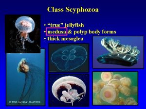 Class Scyphozoa true jellyfish medusa polyp body forms