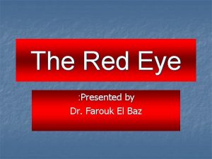 The Red Eye Presented by Dr Farouk El
