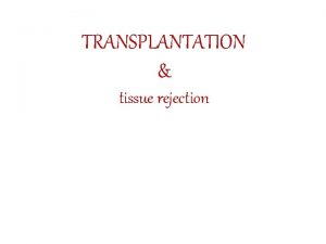 TRANSPLANTATION tissue rejection Organ transplantation Is the moving