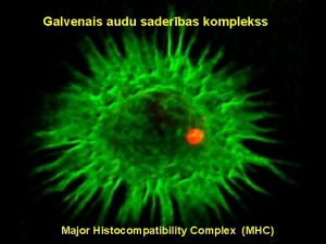 Galvenais audu saderbas komplekss Major Histocompatibility Complex MHC