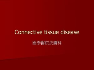 Connective tissue disease Connective tissue diseases n Lupus