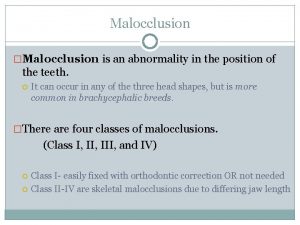 Malocclusion Malocclusion is an abnormality in the position