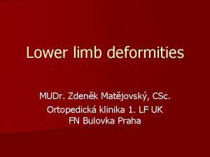 Lower limb deformities MUDr Zdenk Matjovsk CSc Ortopedick