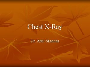 Chest XRay Dr Adel Shannan C X R