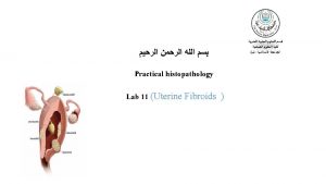 Practical histopathology Lab 11 Uterine Fibroids Cereus membrane
