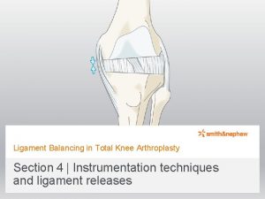 Ligament Balancing in Total Knee Arthroplasty Section 4