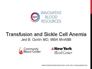 Transfusion and Sickle Cell Anemia Jed B Gorlin