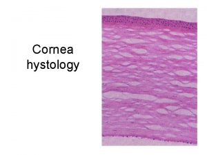 Cornea hystology Bacterial keratitis ETIOLOGY Staphilococcus Streptococcus Pseudomonas