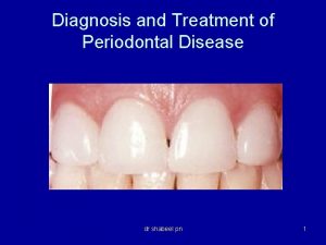 Diagnosis and Treatment of Periodontal Disease dr shabeel