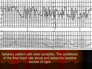 Saltatory pattern with wide variability The oscillations of