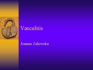 Vasculitis Joanna Zalewska Definition Group of a rare