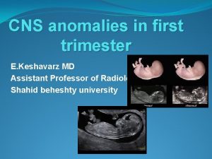 CNS anomalies in first trimester E Keshavarz MD