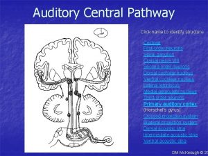 Auditory Central Pathway Click name to identify structure