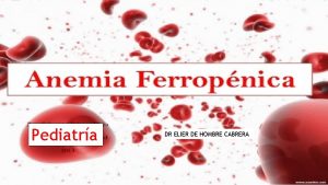 Pediatra DR ELIER DE HOMBRE CABRERA La anemia