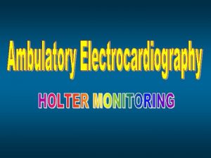 APAKAH ELEKTROKARDIOGRAM Sarana untuk merekam aktifitas listrik jantung