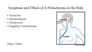 Symptoms and Effects of A Prolactinoma on the