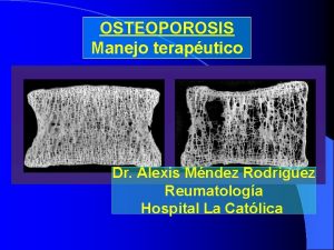 OSTEOPOROSIS Manejo teraputico Dr Alexis Mndez Rodriguez Reumatologa