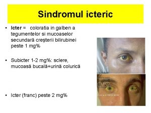 Sindromul icteric Icter coloratia in galben a tegumentelor