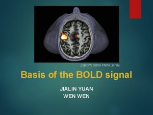ZephyrScience Photo Library Basis of the BOLD signal