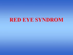 RED EYE SYNDROM AIM To acquaint students with