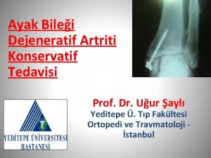 Ayak Bilei Dejeneratif Artriti Konservatif Tedavisi Prof Dr