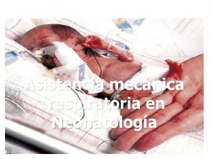 Asistencia mecnica respiratoria en Neonatologa Asistencia respiratoria mecnicas