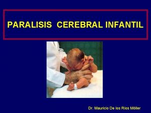 PARALISIS CEREBRAL INFANTIL Dr Mauricio De los Ros