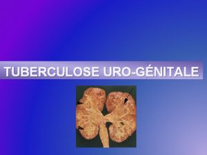 TUBERCULOSE UROGNITALE PLAN INTRODUCTION PATHOGNIE CLINIQUE IMAGERIE DIAGNOSTIC