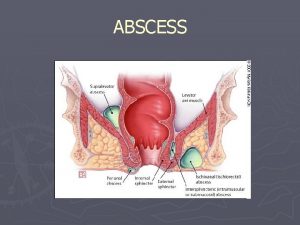 ABSCESS Symptoms anorectal abscess causes severe and continuous