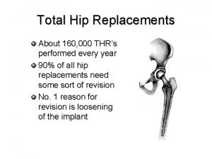 Total Hip Replacements About 160 000 THRs performed