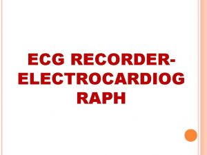 ECG RECORDERELECTROCARDIOG RAPH ECG SIGNAL An ECG is