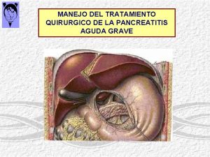 MANEJO DEL TRATAMIENTO QUIRURGICO DE LA PANCREATITIS AGUDA