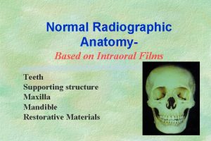 Normal Radiographic Anatomy Based on Intraoral Films Teeth