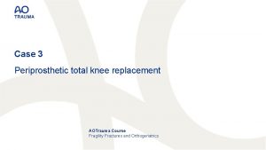 Case 3 Periprosthetic total knee replacement AOTrauma Course