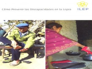 La Enfermedad de Hansen Lepra es una preocupacin