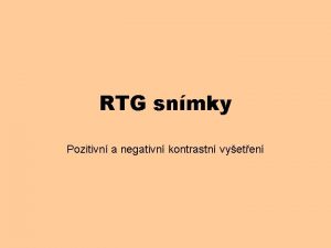 RTG snmky Pozitivn a negativn kontrastn vyeten Kontrastn