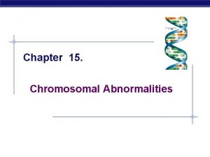 Chapter 15 Chromosomal Abnormalities Chromosomal abnormalities Incorrect number