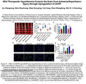 Mild Therapeutic Hypothermia Protects the Brain from IschemiaReperfusion