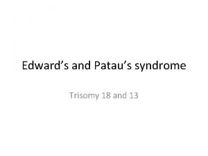 Edwards and Pataus syndrome Trisomy 18 and 13
