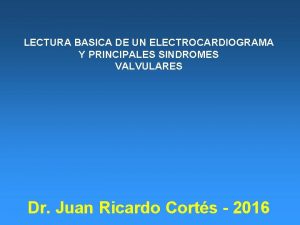 LECTURA BASICA DE UN ELECTROCARDIOGRAMA Y PRINCIPALES SINDROMES