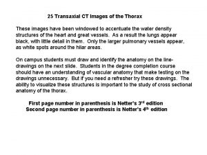 25 Transaxial CT Images of the Thorax These