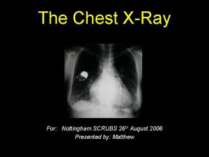 The Chest XRay For Nottingham SCRUBS 26 th