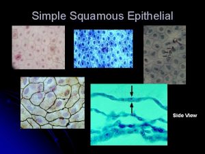 Simple Squamous Epithelial Side View Simple Cuboidal Epithelial
