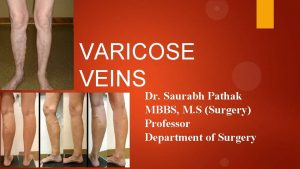 VARICOSE VEINS Dr Saurabh Pathak MBBS M S