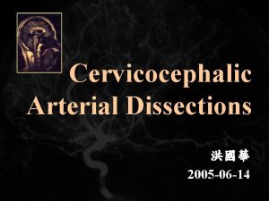 Cervicocephalic Arterial Dissections 2005 06 14 Arterial Dissection