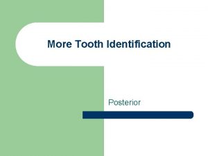 More Tooth Identification Posterior Posterior Maxillary First Premolar