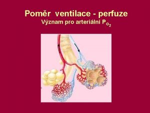 Ventilace perfuze